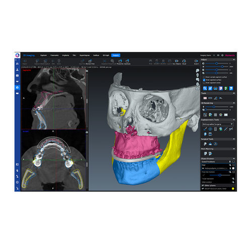 Software medico - Romexis® CMF - Planmeca - per chirurgia / clinico / di visualizzazione