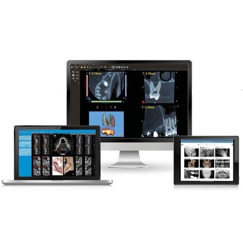 Software di analisi - NNT - NewTom - di gestione / di visualizzazione 3D / diagnostico