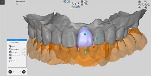 Software odontoiatrico - RAYDENT designer - Ray - di progettazione / per tablet PC