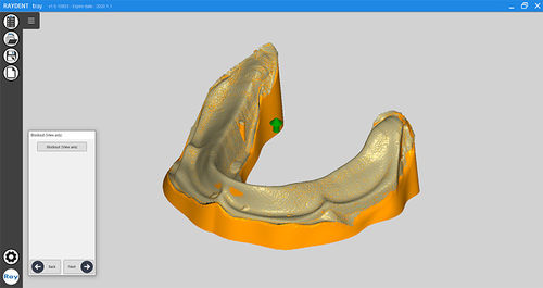 Software odontoiatrico - RAYDENT tray - Ray - di progettazione / di modelizzazione / per tablet PC