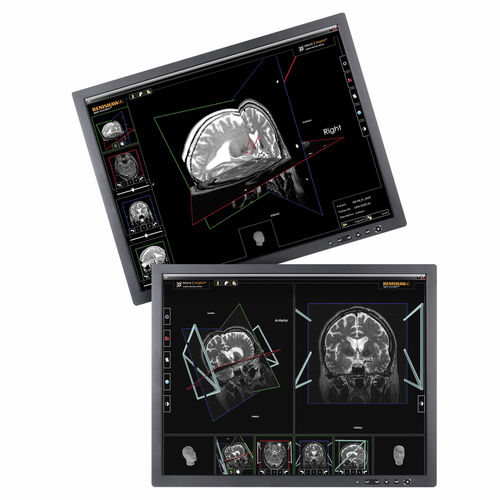 Software di pianificazione preoperatoria - neuroinspire™ - Renishaw - medico / per neurochirurgia stereotassica / automatizzato