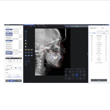 Software di analisi cefalometrica - WillCeph Pro - HDX Will - di progettazione / ortodontico