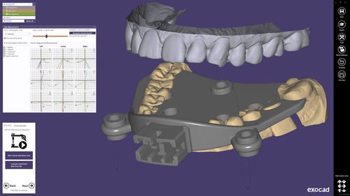 Software di progettazione - exocad  - smart optics Sensortechnik GmbH   - CAD / odontoiatrico / Windows