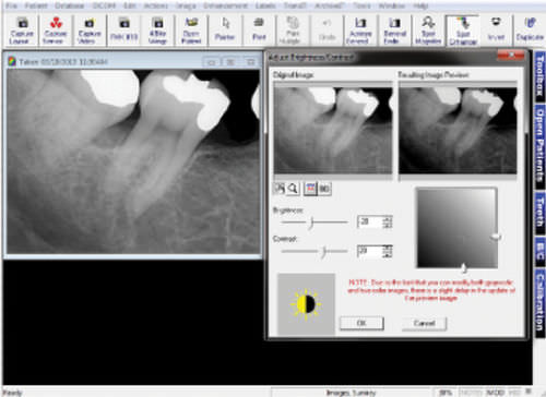 Software di acquisizione di immagini - Prof. Suni - Suni Medical Imaging - di gestione dati / diagnostico / per imaging odontoiatrico