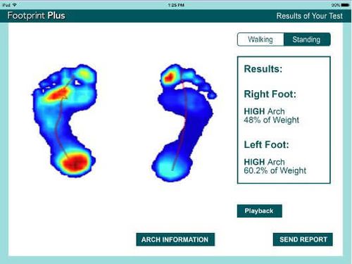 Software per podologia - Footprint Plus™ - Tekscan - di gestione dati / di visualizzazione / di valutazione