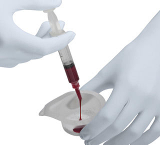 Sostituto osseo sintetico - Ceros® TCP  - Thommen Medical AG   - per chirurgia ortopedica / pasta