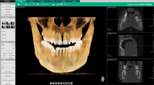 Software odontoiatrico - Ez3D-i™ - VATECH Networks - per imaging odontoiatrico / di analisi / diagnostico