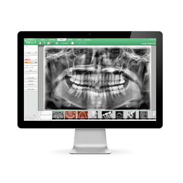 Software per imaging odontoiatrico - EzDent-i™ - VATECH Networks - di analisi di dati / di analisi delle immagini / per reportistica