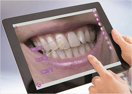Software di visualizzazione - mobileAssist - VITA Zahnfabrik H. Rauter GmbH & Co.KG   - di trattamento / di simulazione / di pianificazione