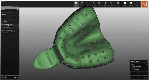 software di simulazione 3D - Zirkonzahn