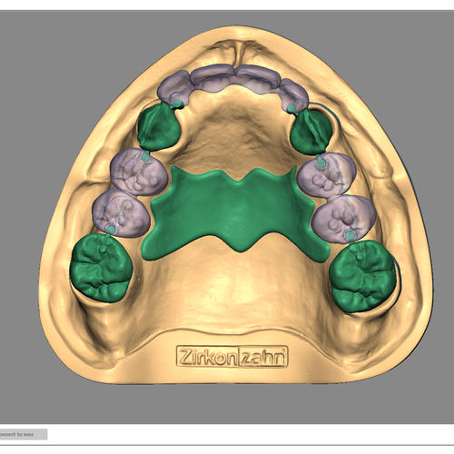 Software per ricostruzione dentale - Partial-Planner - Zirkonzahn - d’importazione / di simulazione 3D / di progettazione di protesi dentale