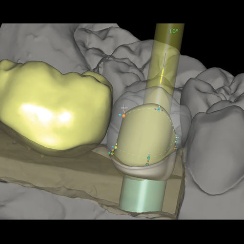 Modulo software per laboratorio dentale - CAD/CAM Abutments - Zirkonzahn - di progettazione di protesi dentale / di fabbricazione
