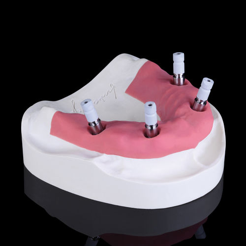 Bodyscan intraorale - White Metal Scanmarker - Zirkonzahn - in metallo / bianco