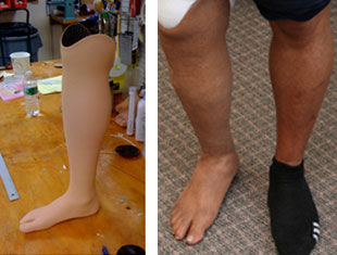 Protesi estetica per gamba - Boston Orthotics + Prosthetics - per adulti