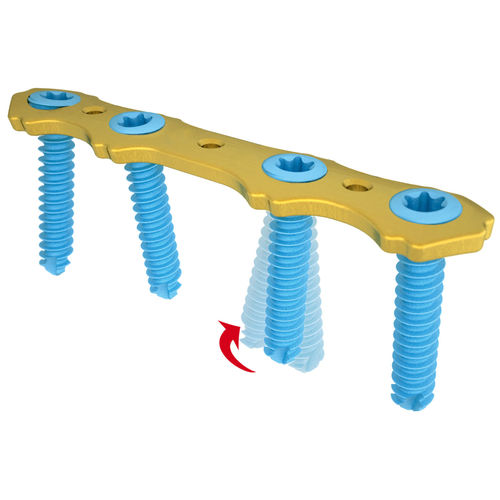 Placca di compressione per metacarpo - Micromed Medizintechnik - bloccata / in metallo