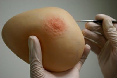 Protesi estetica mammaria - The Anaplastology Clinic - per adulti