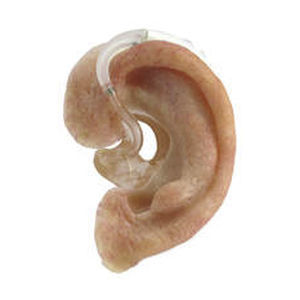 Protesi estetica padiglione auricolare - The Anaplastology Clinic - per adulti