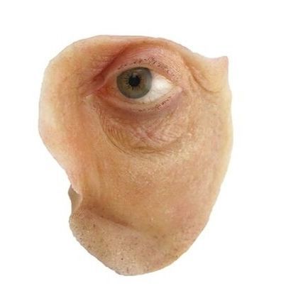 Protesi estetica orbitale - The Anaplastology Clinic - per adulti