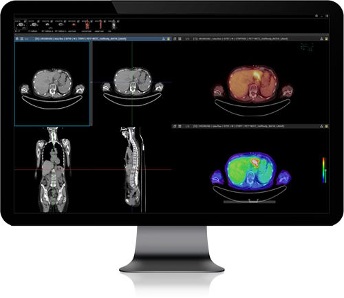 PACS per diagnostica per immagini - INFINITT PACS - Infinitt Healthcare - basato sul web
