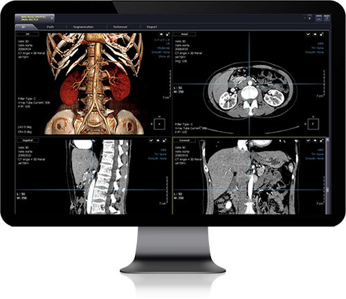 Software di simulazione d'impianto dentale - Xelis - Infinitt Healthcare - per tomografia computerizzata / di file DICOM / per angiografia