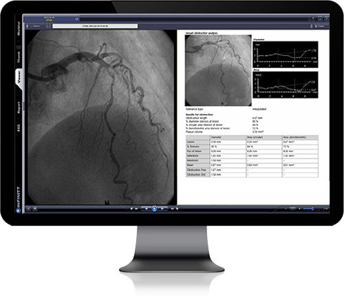 PACS per diagnostica per immagini - Infinitt Healthcare - basato sul web