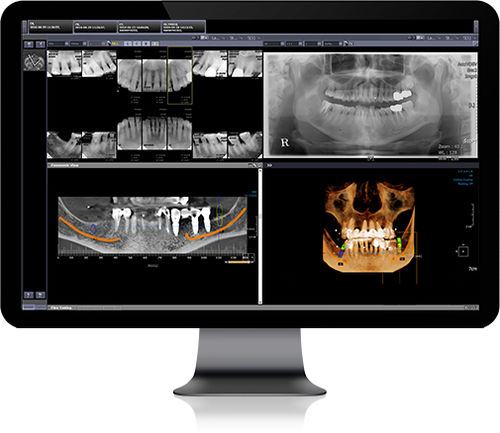 PACS basato sul web - Infinitt Healthcare - medico