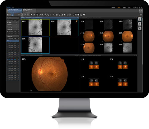 Software di gestione - Infinitt Healthcare - visualizzatore / con sistema di tracciatura / medico