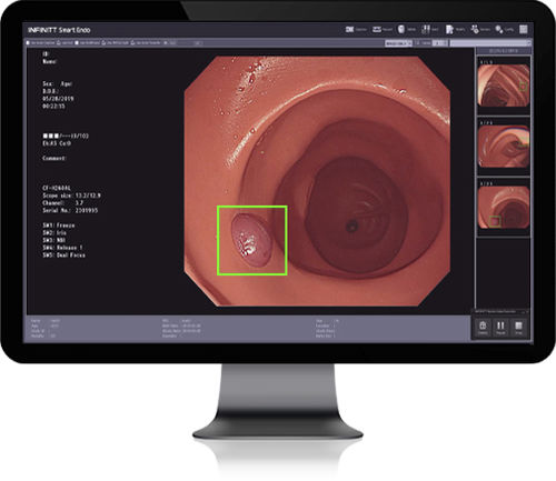 Software di analisi delle immagini - Smart Endo - Infinitt Healthcare - diagnostico / medico