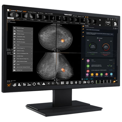 Software di visualizzazione - Paxera AI - PaxeraHealth Corp - diagnostico / di rilevamento / medico