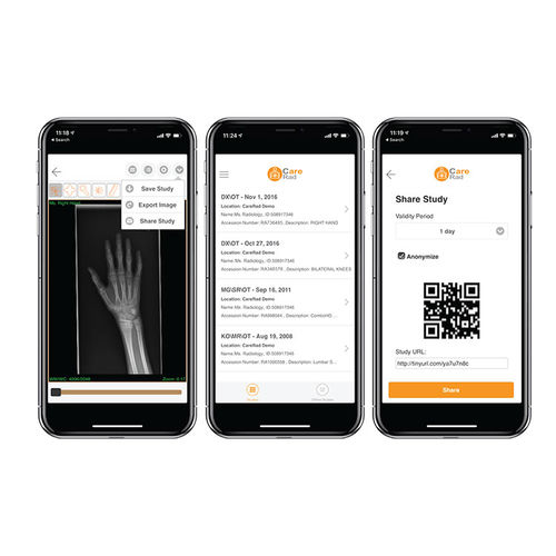 Software di condivisione - CareRad - PaxeraHealth Corp - di analisi delle immagini / di gestione / di controllo