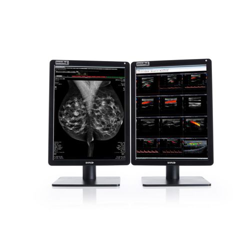 Monitor medico - MDNC-6121 - Barco - diagnostico / per radiologia / per mammografia