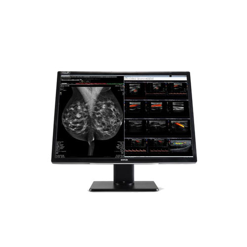 Monitor medico - MDNC‑12130 - Barco - diagnostico / per mammografia / ad alta definizione