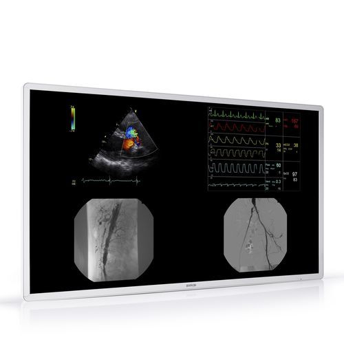 Monitor medico - MDAC-8355 - Barco - per radiologia / ad alta definizione / 4K