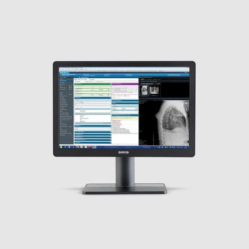 Monitor medico - MDRC‑2424 - Barco - per radiologia / 1920x1200 / 24"