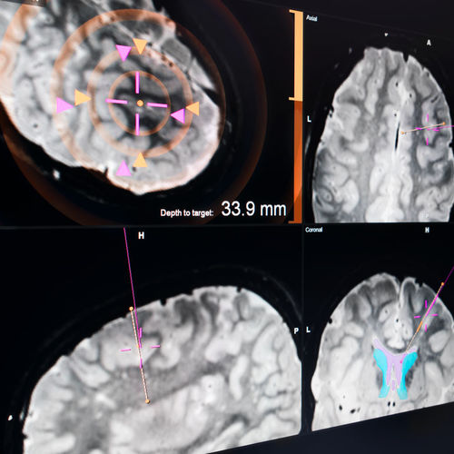 Software per ospedale - EM - Brainlab - per neurochirurgia / di controllo / di calibrazione