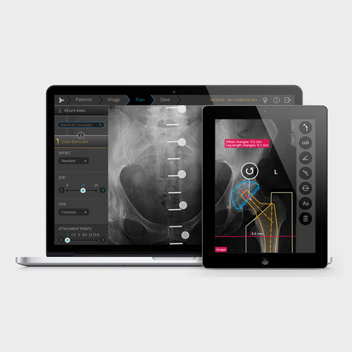 Software medico - TraumaCad® - Brainlab - per ospedale / ortopedico / preoperatorio