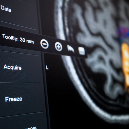 Software per ospedale - Brainlab - per neurochirurgia / di controllo / di visualizzazione