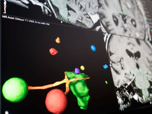 Software di visualizzazione - Brainlab - di pianificazione preoperatoria / di pianificazione del trattamento / di trattamento