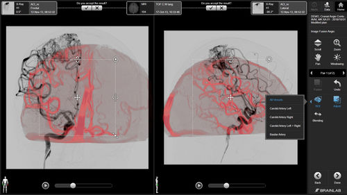 Software di visualizzazione 3D - Brainlab - diagnostico / di trattamento / medico