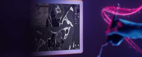 Software medico - Brainlab - per tomografia computerizzata / per chirurgia / di navigazione