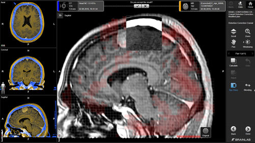 Software medico - Brainlab - neurologico / di pianificazione / di pianificazione del trattamento