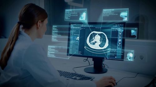 Software di trattamento - Brainlab - con sistema di tracciatura / medico / di polmone