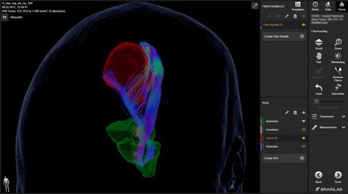 Software medico - Elements  - Brainlab - per neurochirurgia / neurologico / di analisi