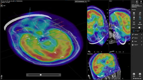 Software medico - Brainlab - clinico / per chirurgia / chirurgico