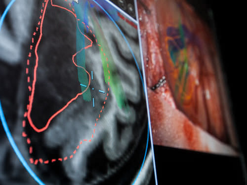 Software per ospedale - Brainlab - per chirurgia / per microscopio operatorio / per chirurgia robotica