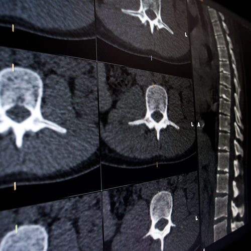 Software medico - Brainlab - per chirurgia del rachide / neurologico / di visualizzazione