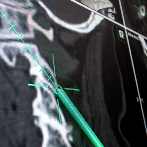 Software di navigazione chirurgica - Brainlab - medico / per ospedale / per tomografia computerizzata