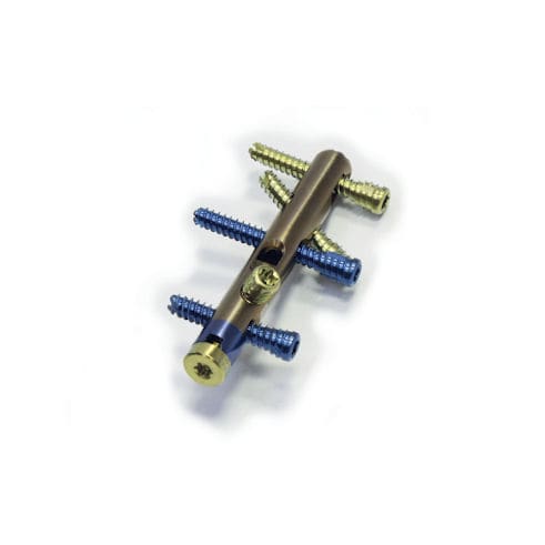 Chiodo intramidollare per calcagno - CHARFIX2 - ChM - destro / sinistro / in titanio
