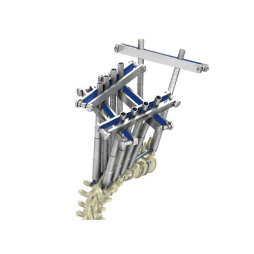 Sistema di posizionamento di viti peduncolari - CHARSPINE2 VD - ChM
