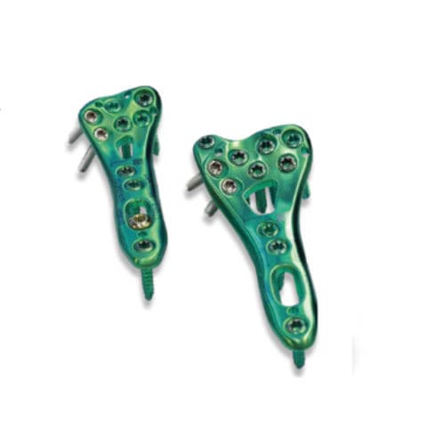 Placca di compressione per radio - 3.72 series - ChM - distale / bloccata / in titanio